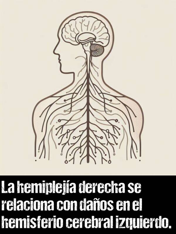 daos: La hemipleja derecha se relaciona con daos en el hemisferio cerebral izquierdo.