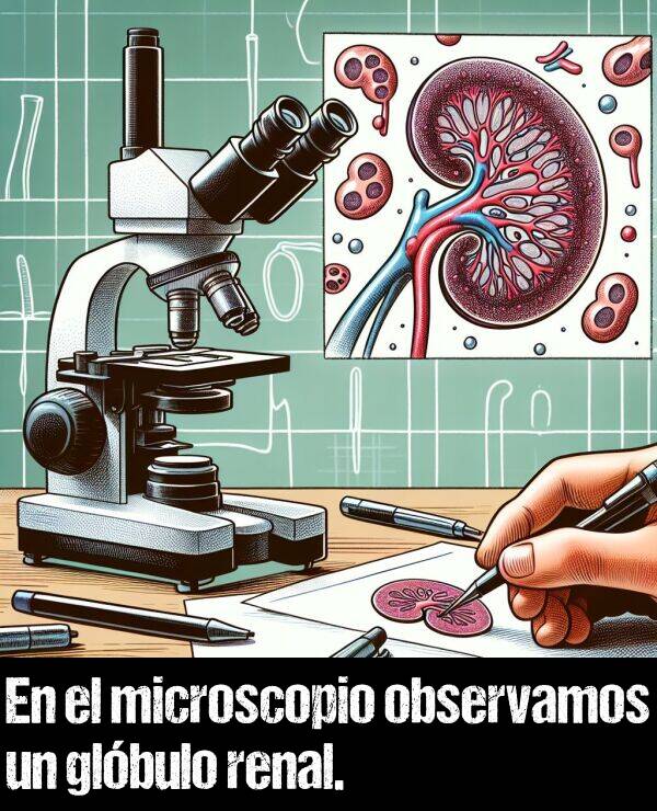 microscopio: En el microscopio observamos un glbulo renal.