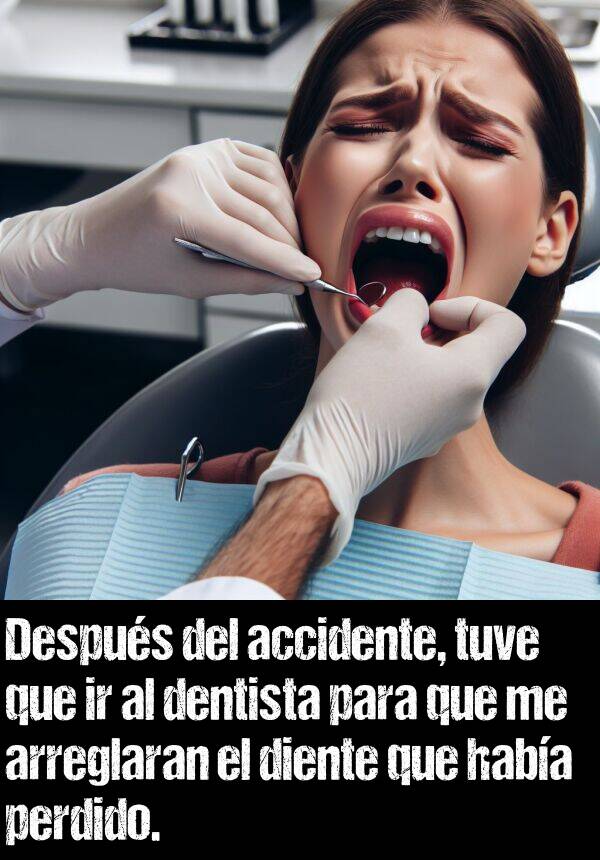 arreglaran: Despus del accidente, tuve que ir al dentista para que me arreglaran el diente que haba perdido.