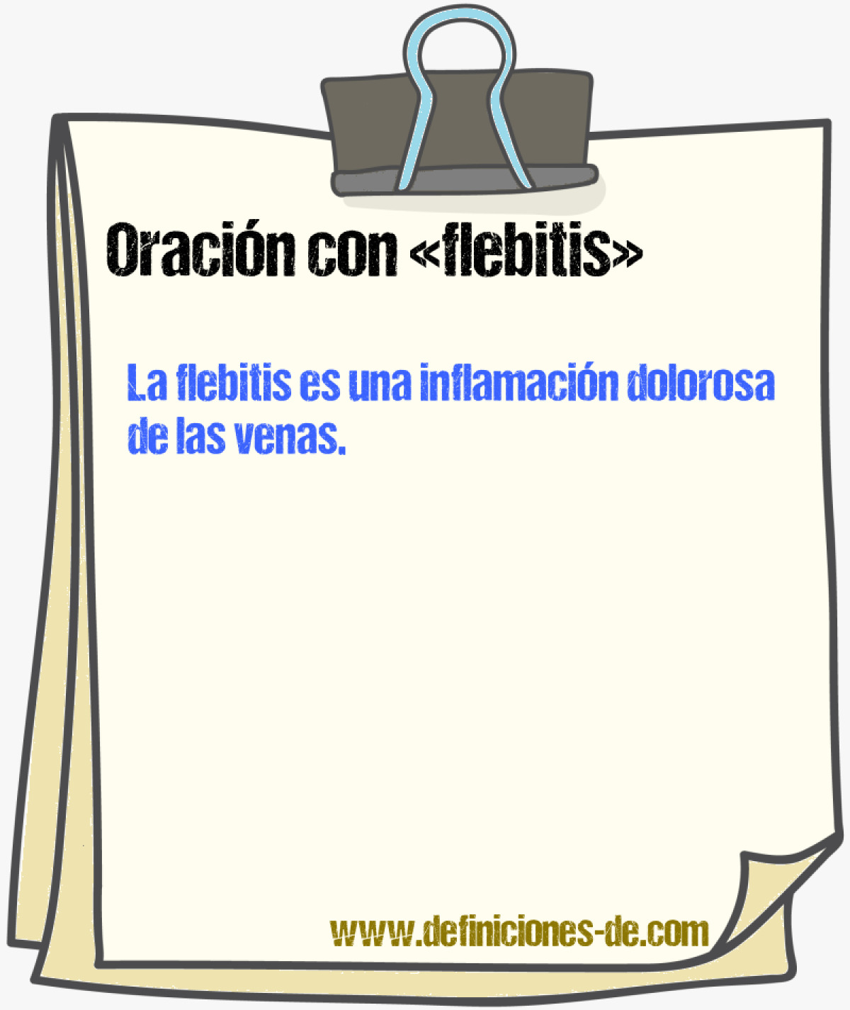 Ejemplos de oraciones con flebitis