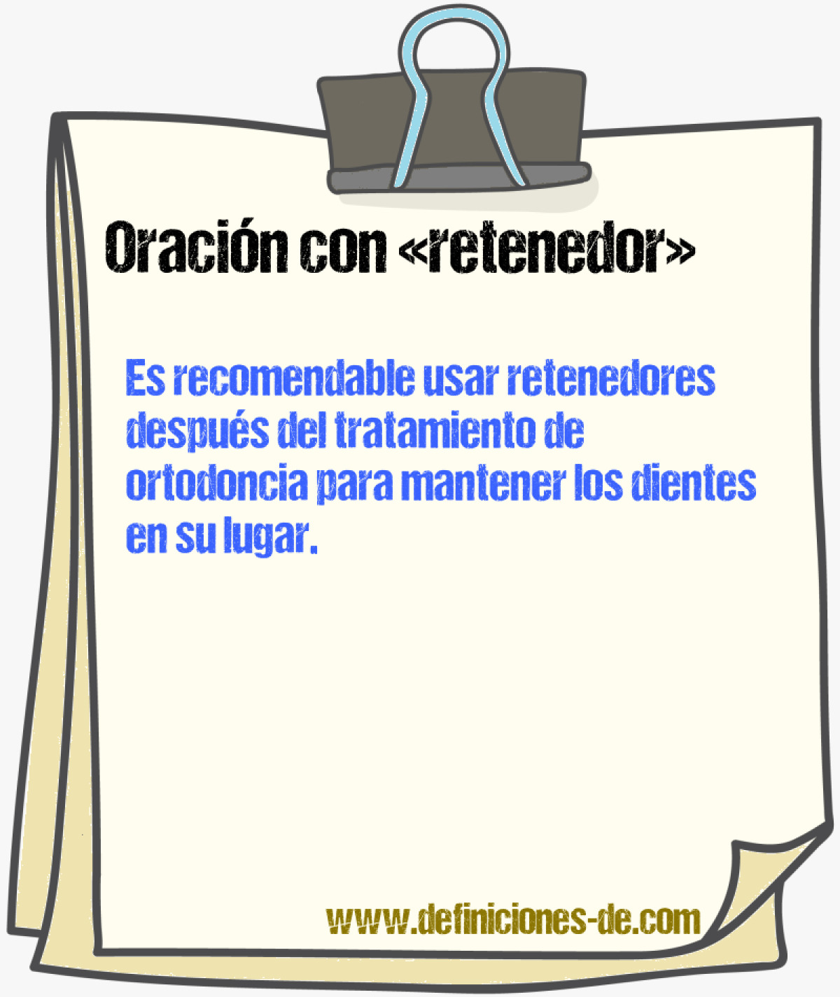 Ejemplos de oraciones con retenedor