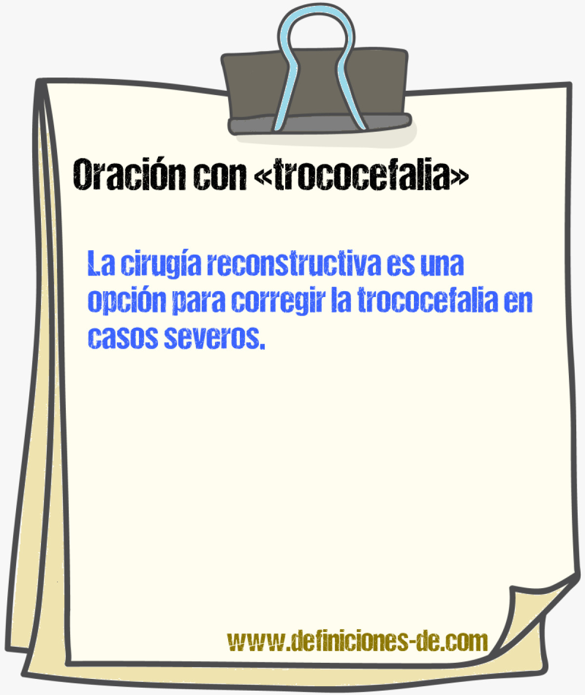 Ejemplos de oraciones con trococefalia